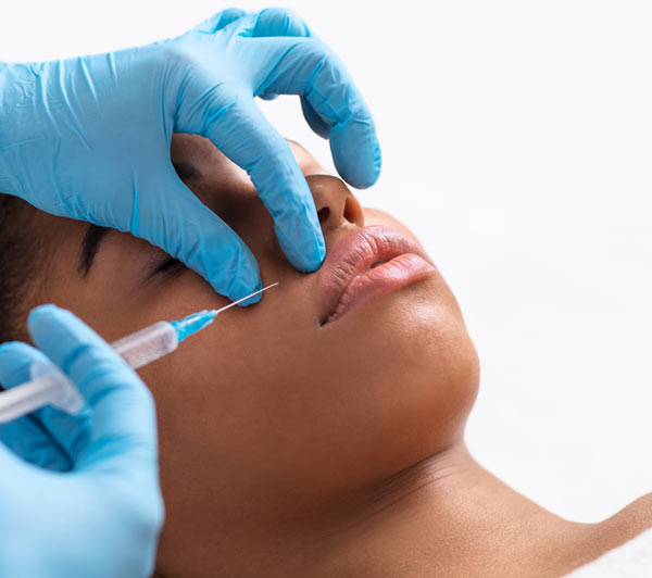 מילוי קמטי "ברקוד"